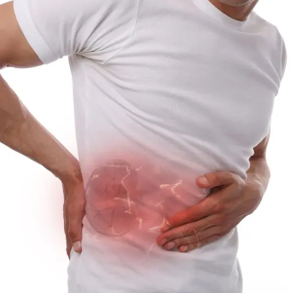 kidney-stones-2024-25