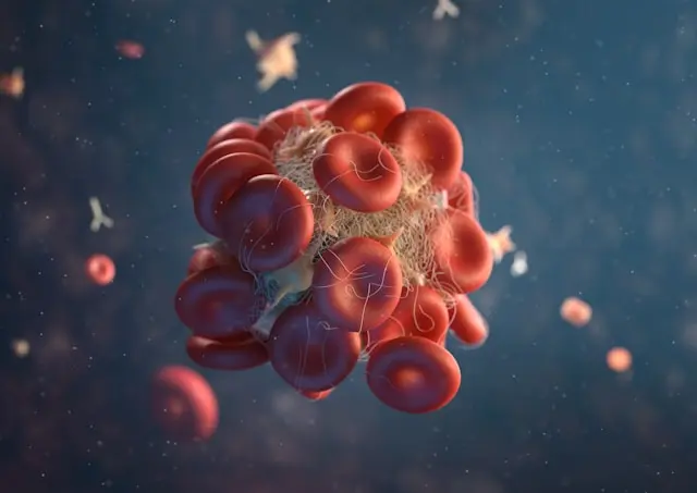 Anemia in chronic kidney disease: why it happens and safe treatment options
