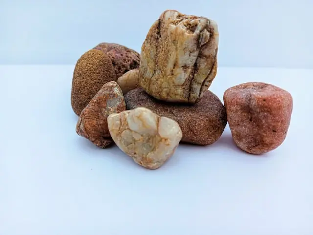 Kidney Stones: Why They Form, How to Prevent Them, and When to See a Specialist