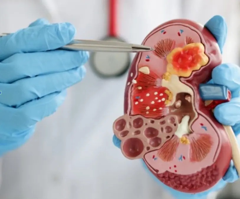 How Nephrologist Monitor Kidney Function