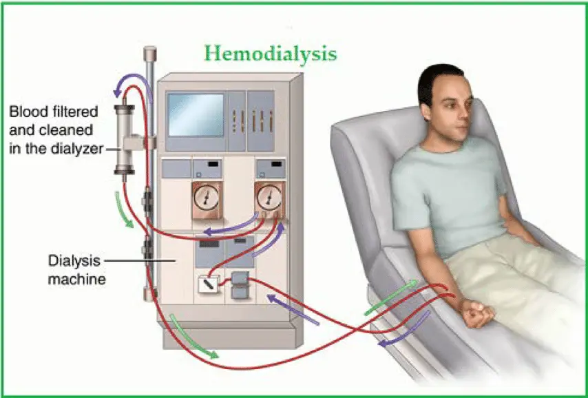 Understanding Your Dialysis Options: Hemodialysis vs. Peritoneal Dialysis
