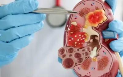 The Benefits of Early Intervention by a Nephrologist