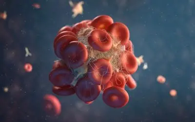 Anemia in chronic kidney disease: why it happens and safe treatment options
