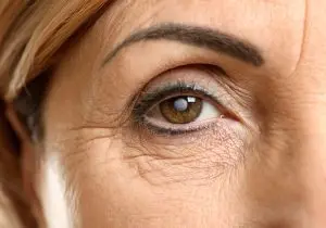 Consultant ophthalmologist examines woman's cataract