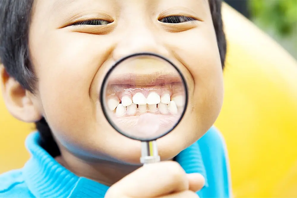 A kid showing his teeth through a magnifying glass after receiving fluoride treatment for healthy teeth
