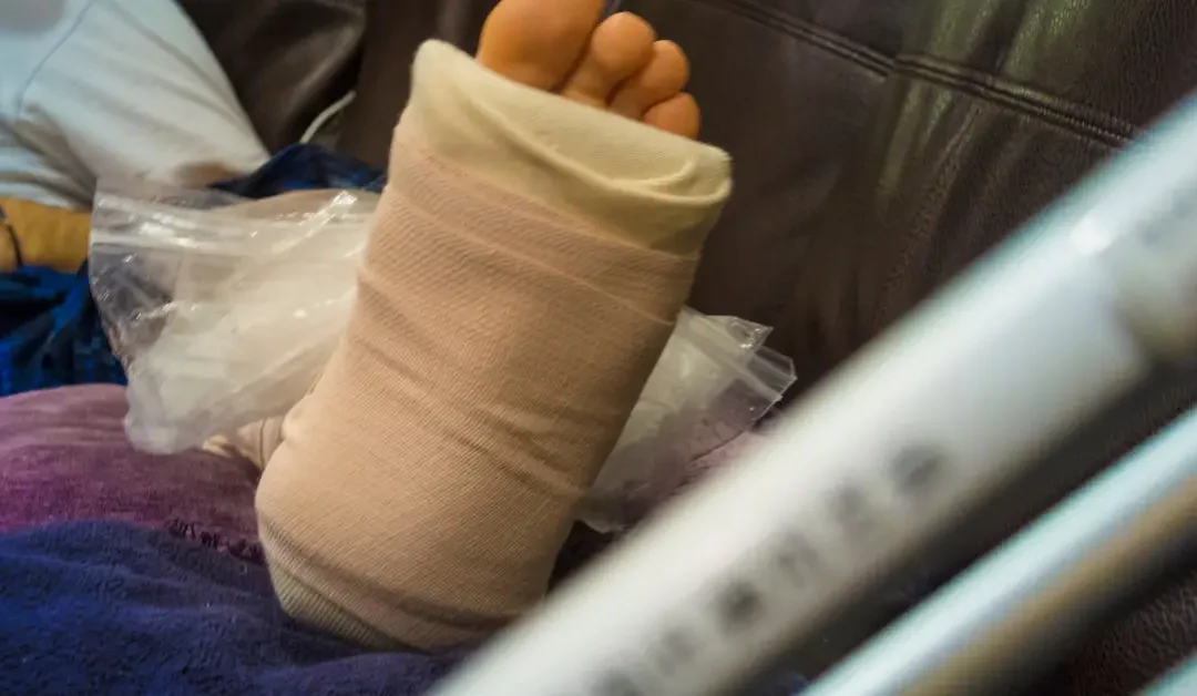 Understanding The Difference Between Sprains, Strains, And Fractures