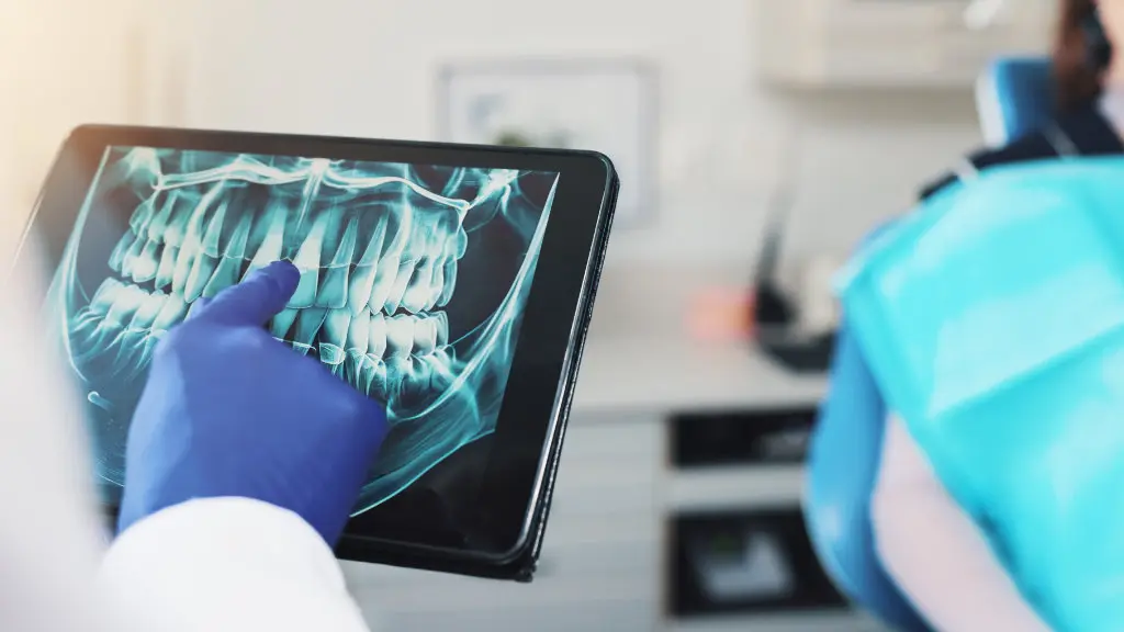 Dentist reviewing dental X-rays to assess need for tooth extraction