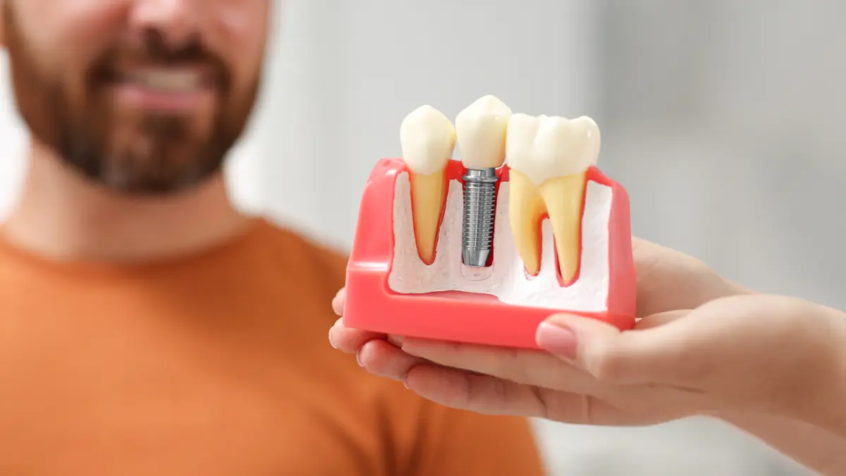 Close-up of dental implant model demonstrating missing tooth replacement
