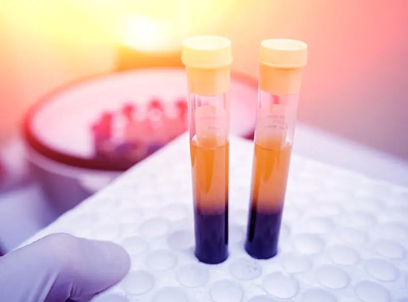 TB Testing