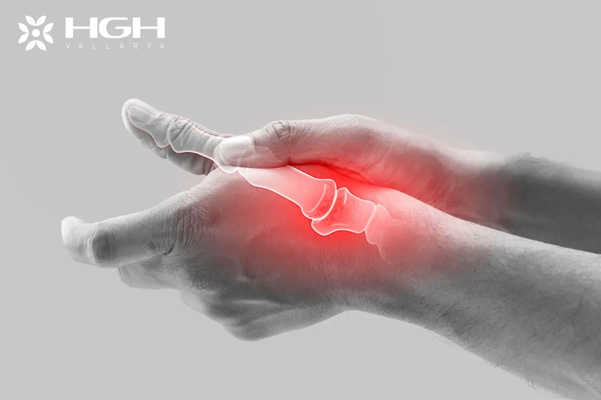 Arthritis 1 1 Description