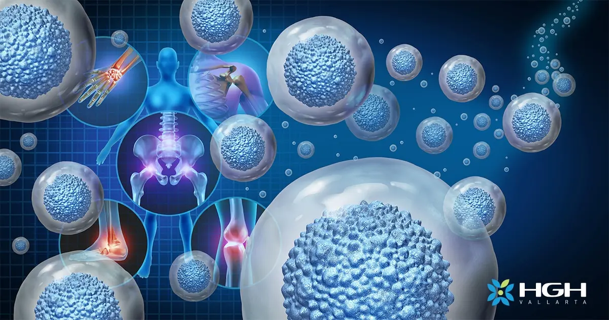 Stem Cell Therapy