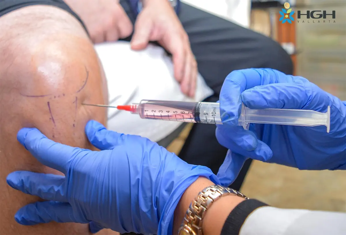 Why You Should Consider Stem Cell Therapy in Mexico? 4 Stem Cell Injection into Knee
