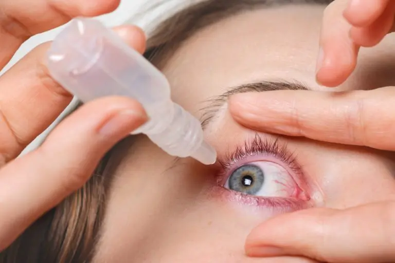 dry eyes