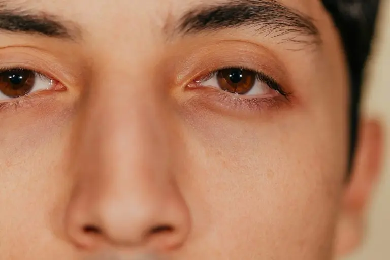 Summer Dry Eye