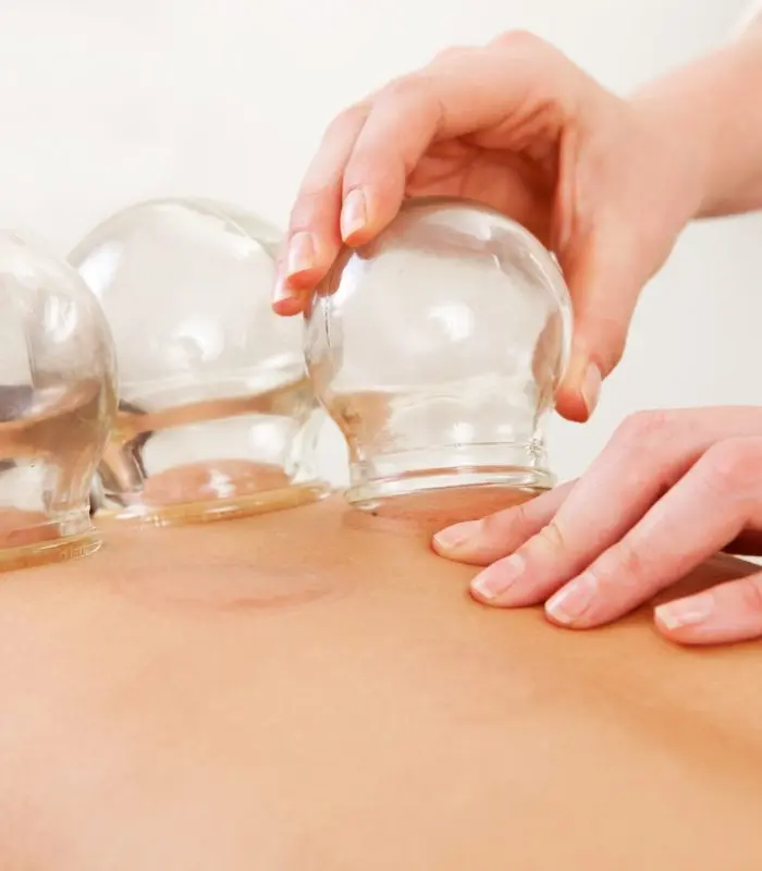 Detail,Of,An,Acupuncture,Therapist,Removing,A,Glass,Globe,In