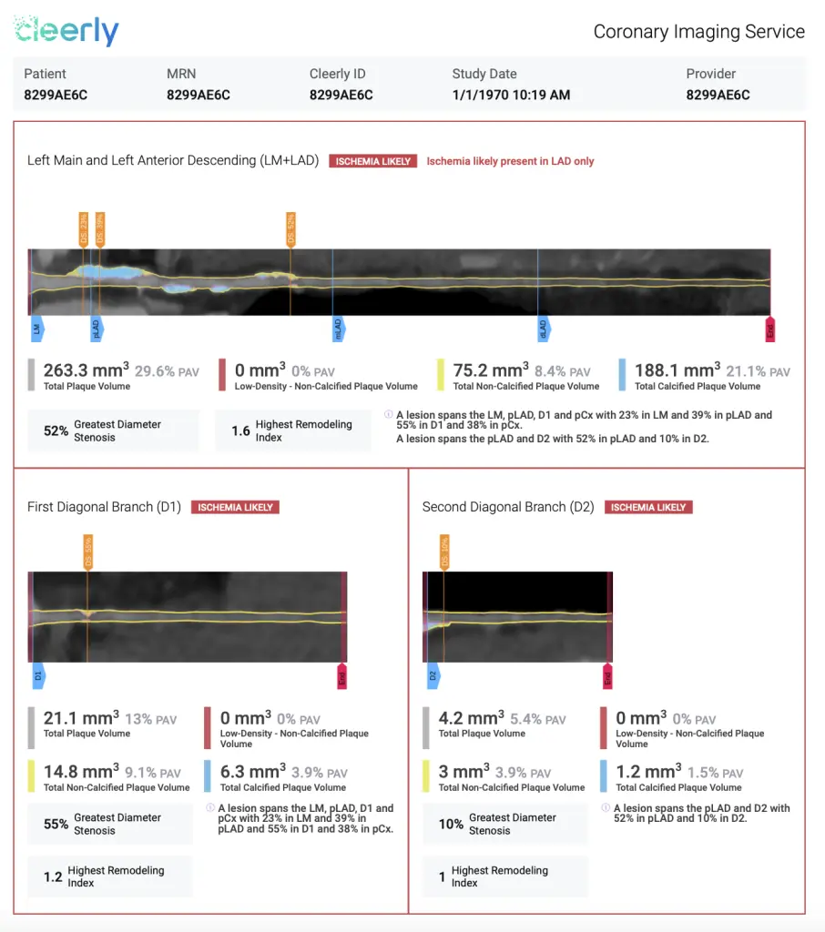 Cleerly Sample Report 3