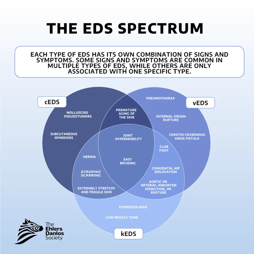 EDS Spectrum