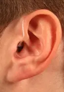 Receiver-In-The-Ear (RITE) Hearing Aids