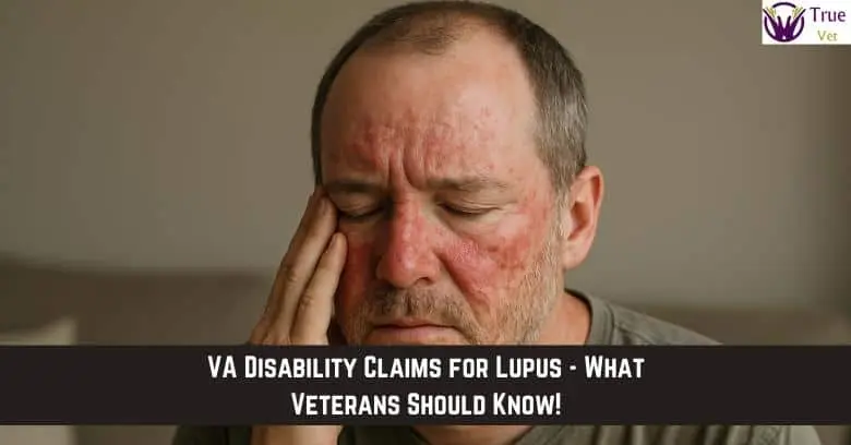 VA disability claim for lupus, veteran with hand on face, seeking help.
