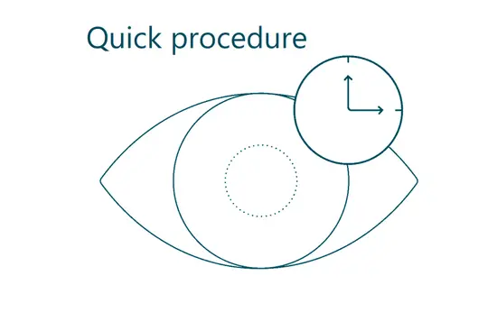 Benefit of ICL lenses #2: quick procedure