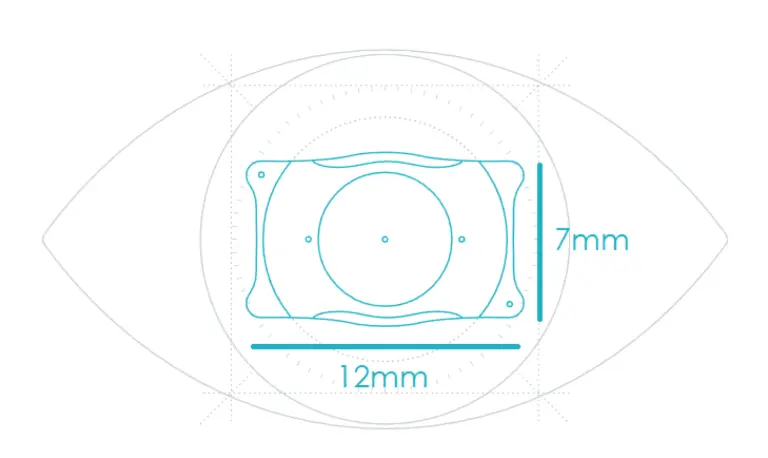 Visian ICL intraocular lens, 7mm x 12mm