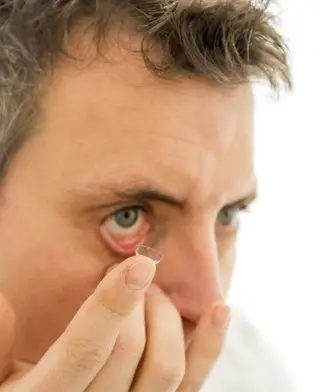 contact lens laser eye surgery