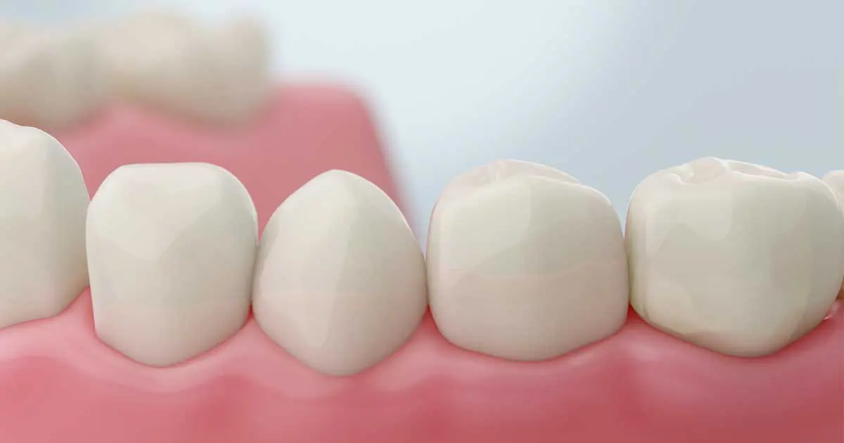 Fluoride: Strong Teeth or Hidden Risks?