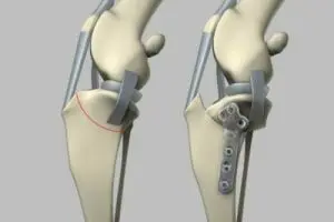 TPLO for surgical repair of CCL in dogs