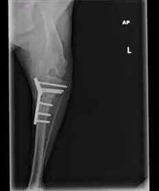 TPLO Post-op VD