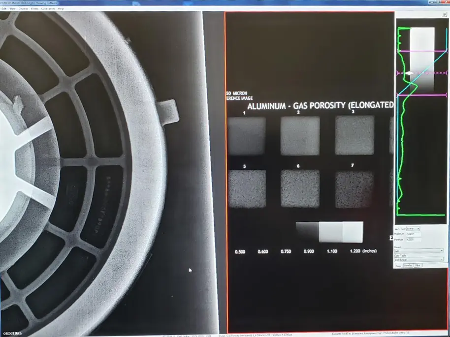 Radiography Xray 1