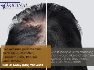 Hair Loss Restoration Treatment Phoenix AZ