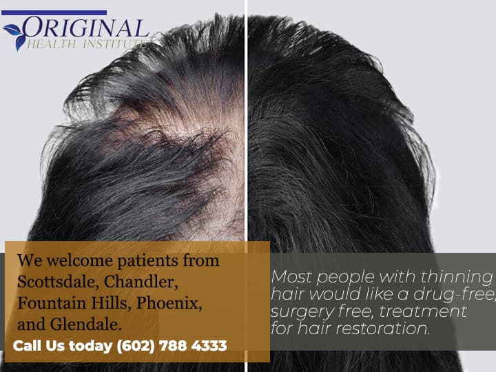 Hair Loss Restoration Treatment Phoenix AZ
