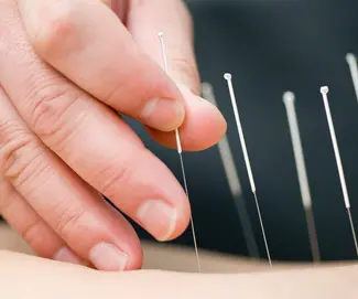 acupuncture phoenix