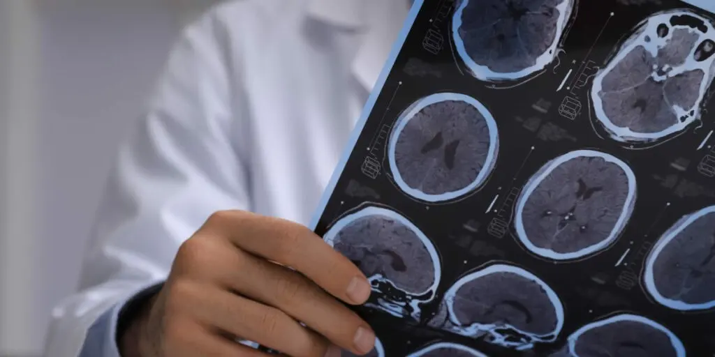 What Causes Brain Injury? | Spokane Valley, WA | Call (509) 495-1246