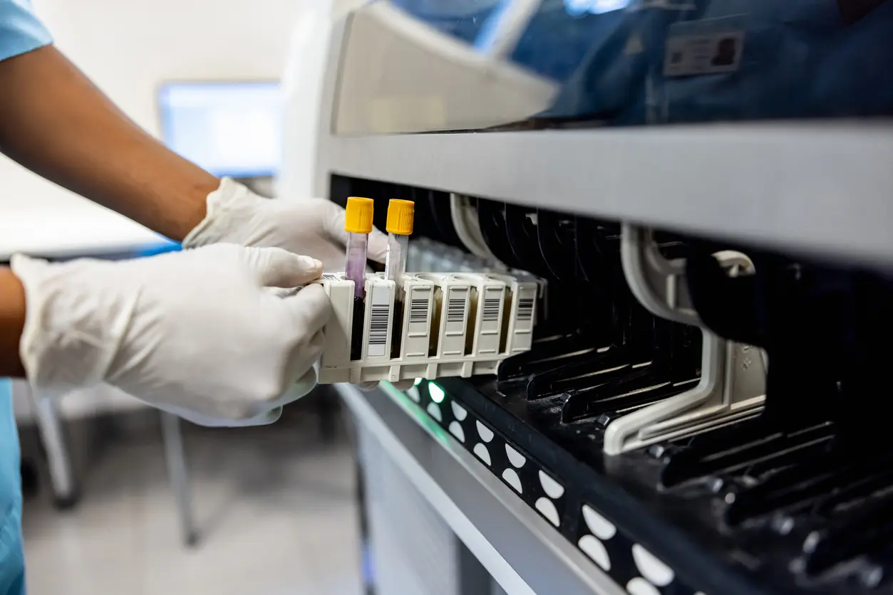 Close-up on a technician analyzing blood samples at the lab and holding a test tube - healthcare and medicine