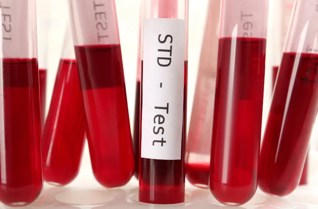 STD Testing
