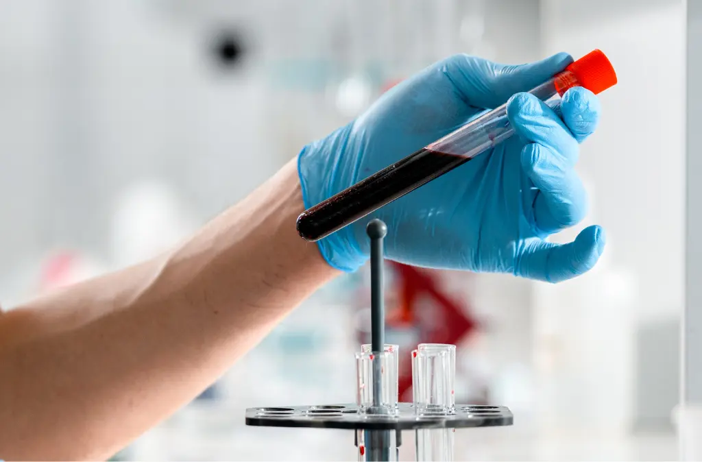 How Much Is STD Testing And What Does STD Testing Include? 8 STD Testing