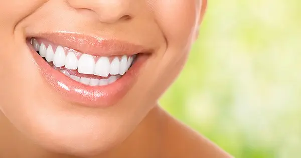 Photo of women with beautiful teeth after teeth whitening in Greenwood Village