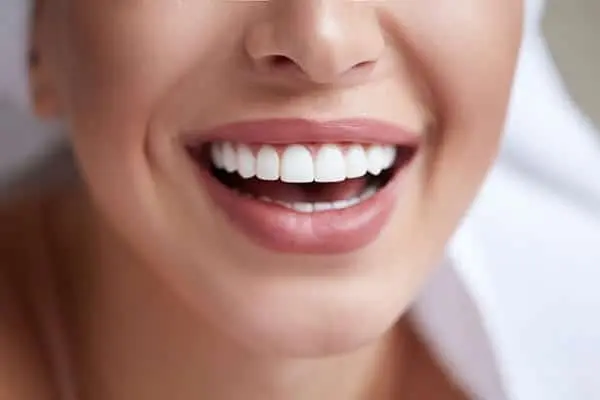Woman with beautiful dental veneers in Greenwood Village, CO