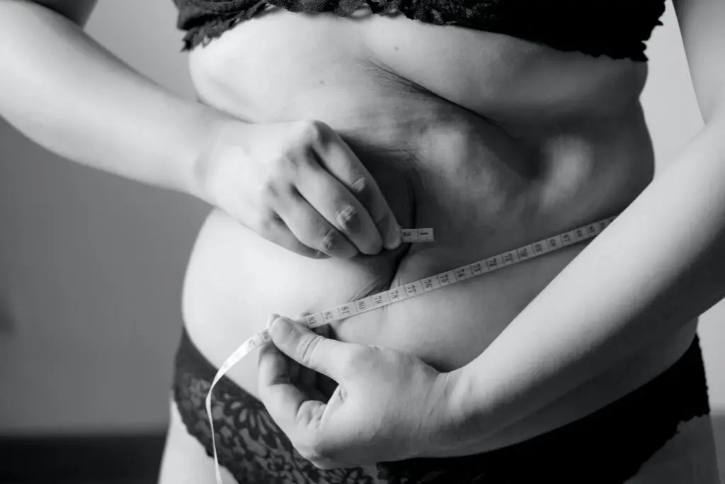 Subcutaneous Fat