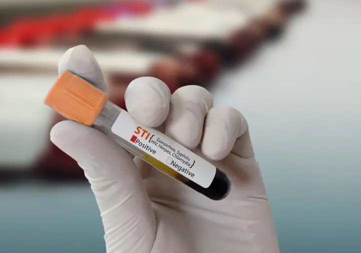STI Testing