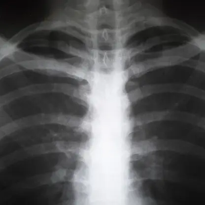 xray near me