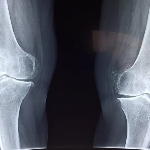 xrays near me
