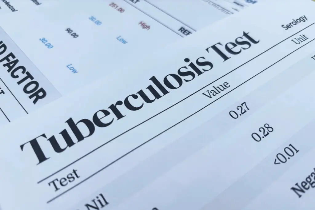 TB Test