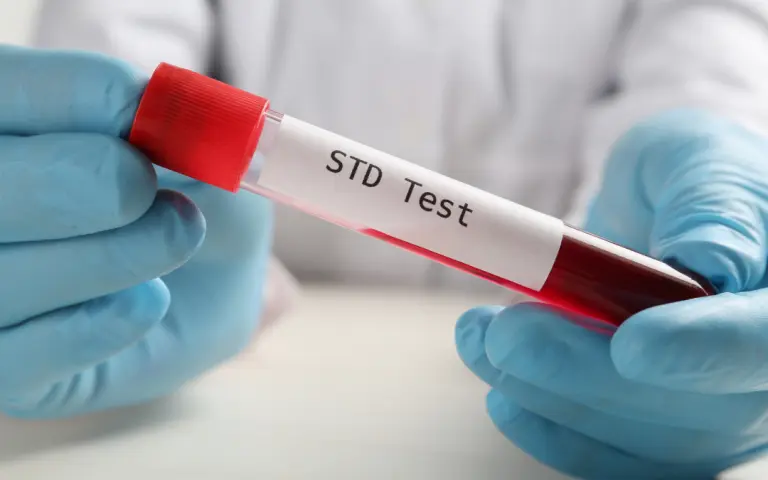 STD Testing