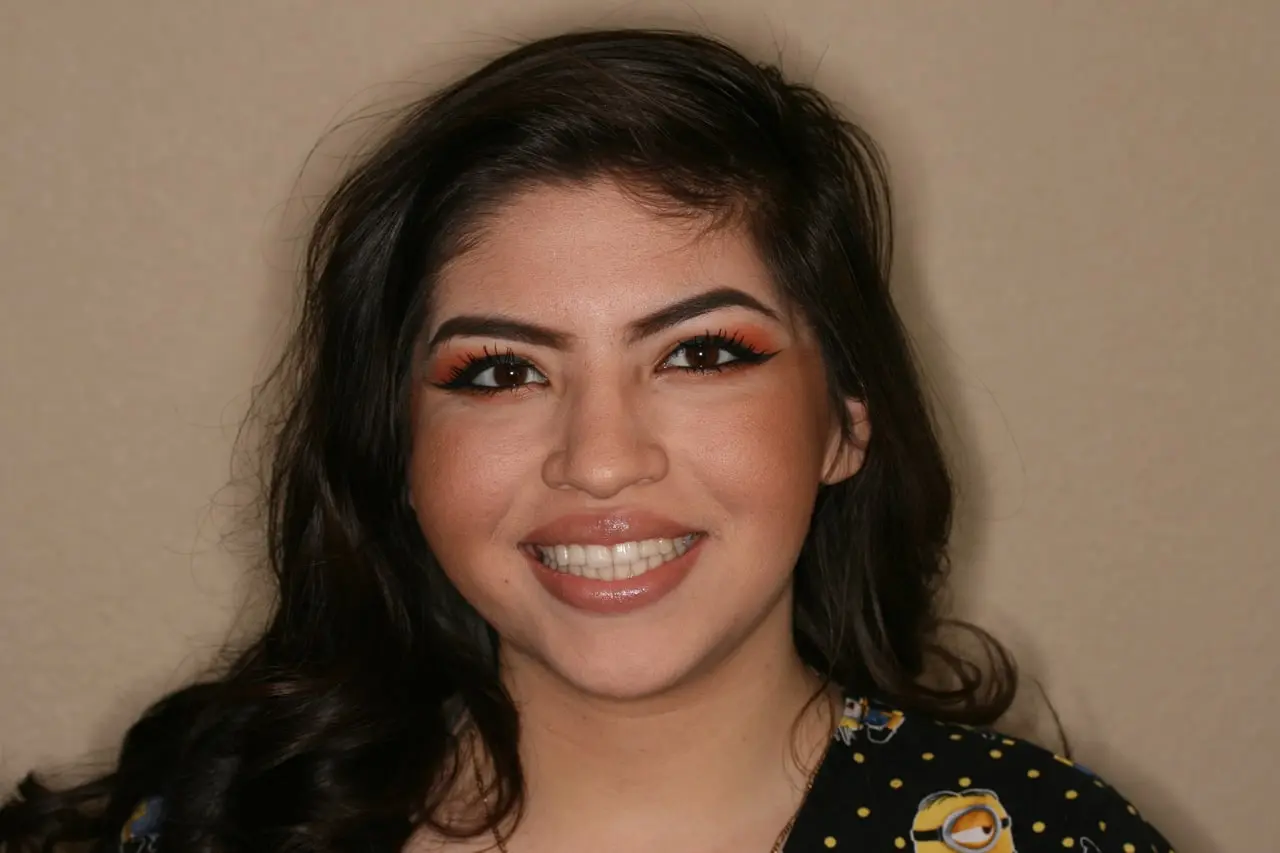 Woman smiling showing her teeth after Invisalign treatment