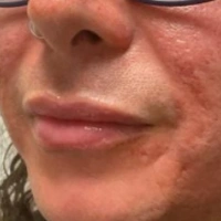 before-and-after transformations at Boulder Valley Laser & Cosmetic 