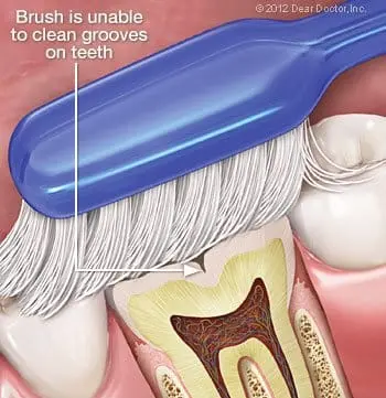 Sealants 1 237944