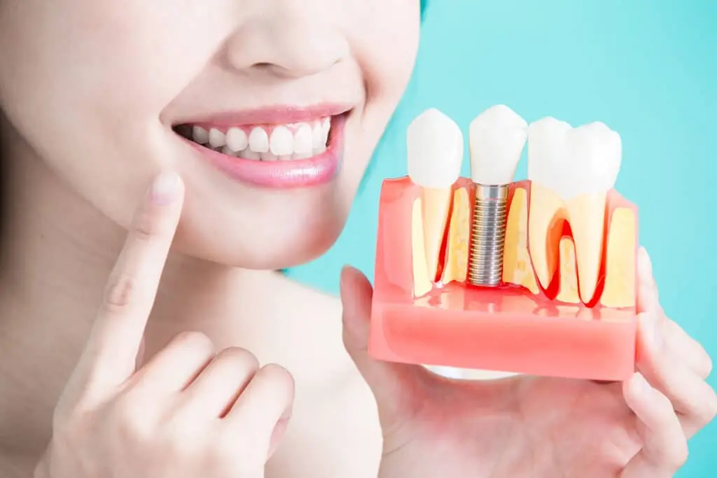 woman smiling and showing her teeth
