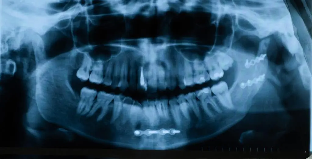 scan of a dental bone injury